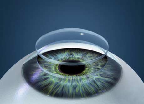 Simulación que muestra la córnea separada del ojo