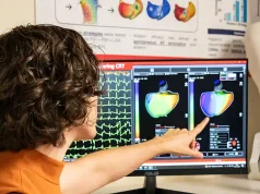 La IA alcanza un 89% de precisión en la localización de la cardiomiopatía auricular