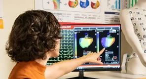 La IA alcanza un 89% de precisión en la localización de la cardiomiopatía auricular