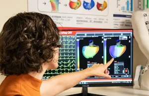 La IA alcanza un 89% de precisión en la localización de la cardiomiopatía auricular