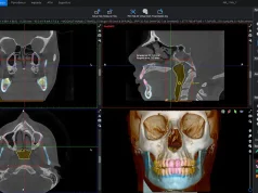 ¿Puede la inteligencia artificial ver lo que el ojo humano no ve? Inteligencia artificial y tomografía de haz cónico en odontología