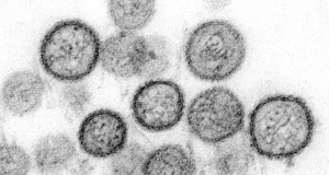 Alerta en América por hantavirus: expertos piden reforzar medidas y consulta oportuna