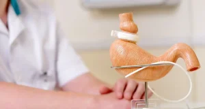¿Te operaste para bajar de peso? la alimentación, la microbiota y del acompañamiento profesional son claves para superar las cirugías bariátricas