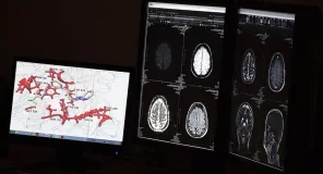 Identifican tres moléculas entre diez mil analizadas que podrían ser la base de futuros fármacos contra el Alzheimer