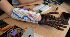 Investigadores argentinos desarrollan una prótesis de bajo coste para personas con amputación que responde a impulsos musculares