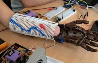 Investigadores argentinos desarrollan una prótesis de bajo coste para personas con amputación que responde a impulsos musculares