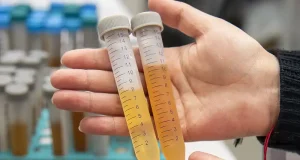 Lactosuero, de residuo a ingrediente de alto valor para la industria alimentaria y farmacéutica