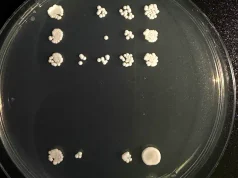 Una colaboración entre la Universidad de Oviedo y Harvard identifica una nueva diana para combatir la infección por «Candida albicans»