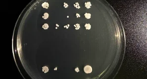 Una colaboración entre la Universidad de Oviedo y Harvard identifica una nueva diana para combatir la infección por «Candida albicans»