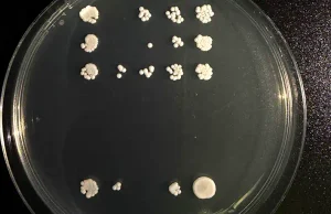 Una colaboración entre la Universidad de Oviedo y Harvard identifica una nueva diana para combatir la infección por «Candida albicans»