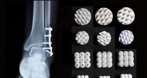 El propóleo de las abejas puede regenerar huesos tras fracturas graves, extirpación de tumores u osteoporosis