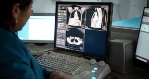 En segundos se podría estimar la gravedad del edema pulmonar
