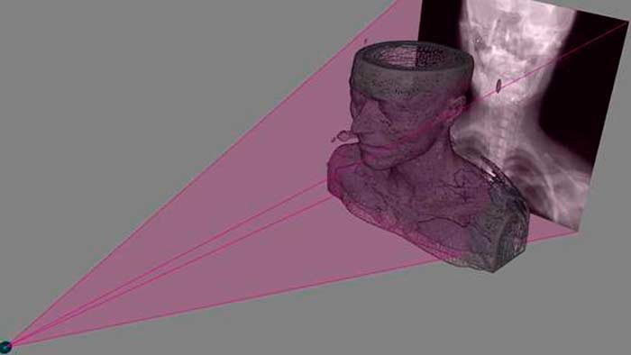 Imagen en 3D obtenida a partir de una radiografía. 