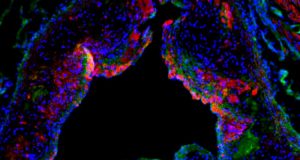 Descubren una molécula que acaba con la grasa de las arterias