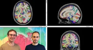 HoliAtlas incluye hasta 350 zonas del cerebro es uno de los mapas sobre este órgano vital más detallados del mundo