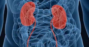 Un ensayo demuestra que es seguro reducir los inmunosupresores en pacientes con trasplante renal
