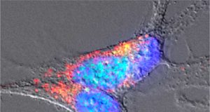 El Instituto de Neurociencias premiará los mejores trabajos sobre neurobiología con 25.000 euros