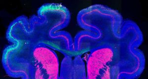 Alzheimer: lo relacionan con los fallos de los flujos de energía hacia el cerebro