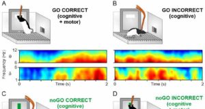 Un estudio revela cómo diferentes áreas del cerebro procesan información cognitiva y motora