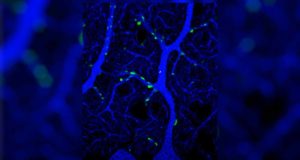 Así se forma la sinapsis en el cerebelo, clave para transmitir las órdenes del cerebro