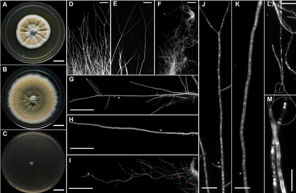 Hongo extremófilo visto al microscopio.