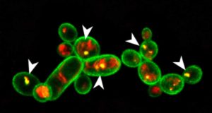 Descubren una bacteria que es el mejor escudo para cultivos frente ataques de hongos y nemátodos