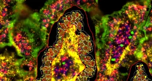 Desvelan el mecanismo que predispone a sufrir enfermedades metabólicas