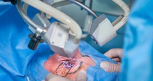 El sistema de inteligencia artificial para mejorar las operaciones de cataratas