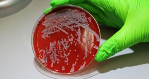 El estudio más detallado de cómo se adapta la bacteria del estafilococo a los seres humanos