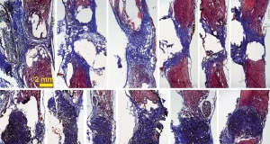 Una posible solución para lesionados medulares: está hecha con grafeno y ha funcionado en ratas