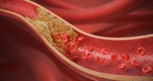 Encuentran una proteína clave en el aumento del riesgo cardiovascular en personas con colesterol