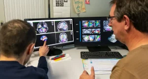 Salud del cerebro: las enfermedades del cerebro son la principal causa de años vividos con discapacidad