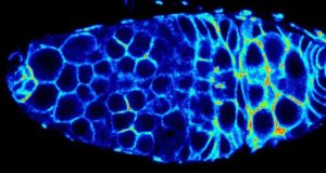 Identifican compuestos naturales que previenen la acumulación de hierro en las enfermedades mitocondriales