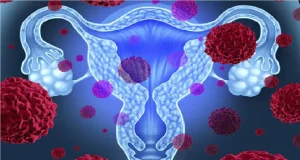 El cáncer de cuello uterino causa la muerte de cerca de seiscientas mujeres al año en Chile