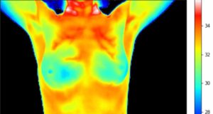 Termografía: la técnica sencilla y de bajo coste para detectar hasta los tumores de mama más ocultos