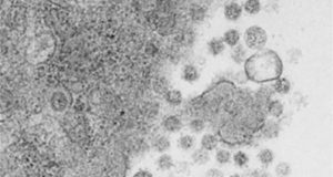 Una vacuna nueva elimina el virus de la Covid-19 en ratones: asegura una protección del 100%