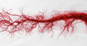 Descubren el causante de la inflamación de las arterias que aparece a partir de los 50 años