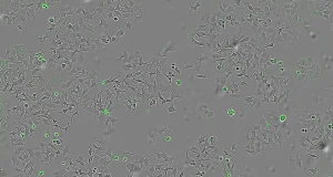 Algunas bacterias puede destruir las células de los tumores