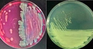 El cóctel de bacterias que se comen los plásticos de suelos contaminados