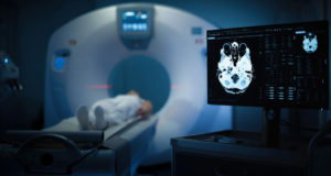 El sistema que cambia radicalmente el diagnóstico de enfermedades del cerebro