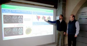 Identifican un biomarcador para la detección del alzhéimer