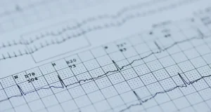 Un sistema inteligente para leer electrocardiogramas y detectar problemas cardiacos