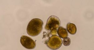 Detectan por primera vez en el Mediterráneo una microalga tóxica que contamina el pescado