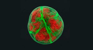 Las células de la leucemia tienen una ‘memoria mecánica’ que influye en los tumores