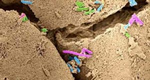 Descubren un indicador que avisa de la disbiosis, un desequilibrio del microbioma intestinal