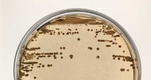 Un estudio revela un mecanismo de las bacterias para resistir a los fármacos desconocido hasta ahora