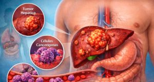 Identifican un mecanismo que activa el sistema inmune contra el cáncer de hígado