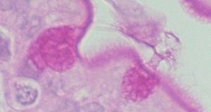 Una molécula de la microbiota intestinal, un arma contra las enfermedades mitocondriales