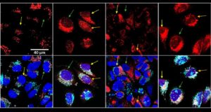 Más daño al tumor con menos quimioterapia: una nueva estrategia basada en calor con radiación infrarroja