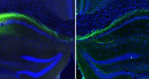 El cerebro empieza a organizar cómo veremos el mundo antes de que abramos los ojos